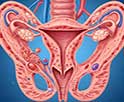 Endometriosis: What Are the Latest Pills Available?